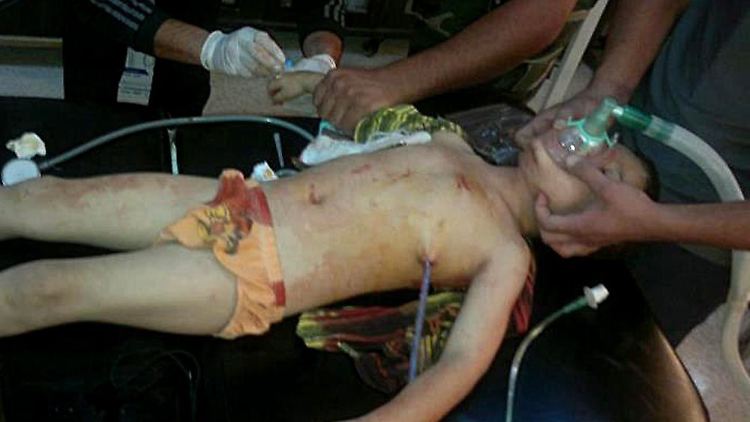 Ein verletzter syrischer Junge in der Notaufnahme einer Klinik.