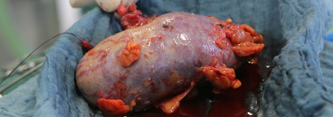 Eine Spenderniere vor der Transplantation.