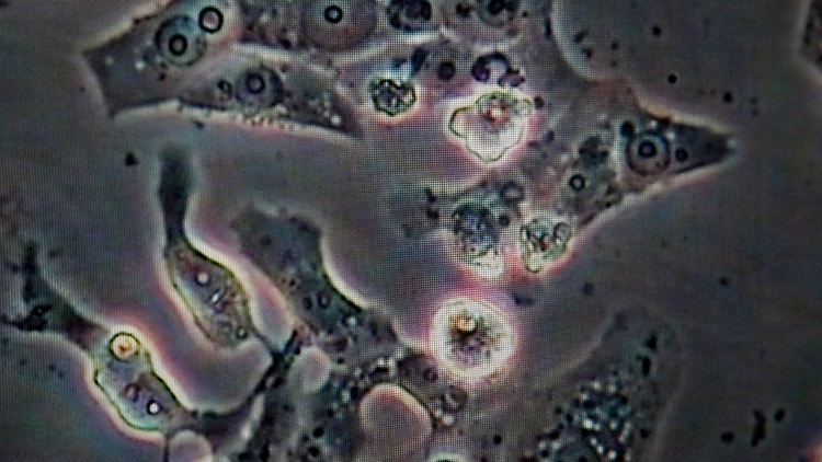 Zellprobe einer Infizierten Amsel: Die Zellen sind vom Usutu-Virus völlig zerstört.