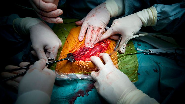 Ärzte verschließen nach einer Nierentransplantation die Wunde.