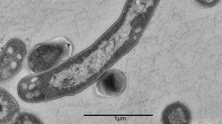 Tuberkulose-Erreger in der Vergrößerung.