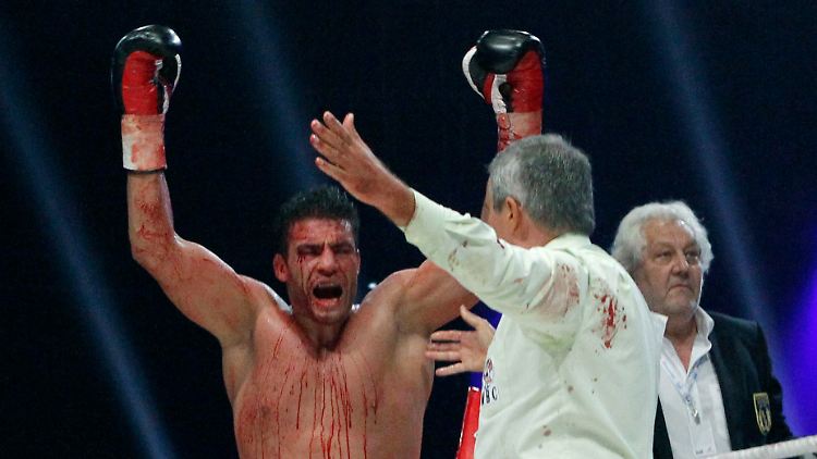 Blutig und sauer: Manuel Charr nach dem vorzeitigem Abbruch seines Titelkampfes in Moskau.