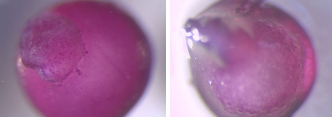 Mikroskopische Aufnahmen von Mausknorpel mit (l) und ohne Arthrose (r).