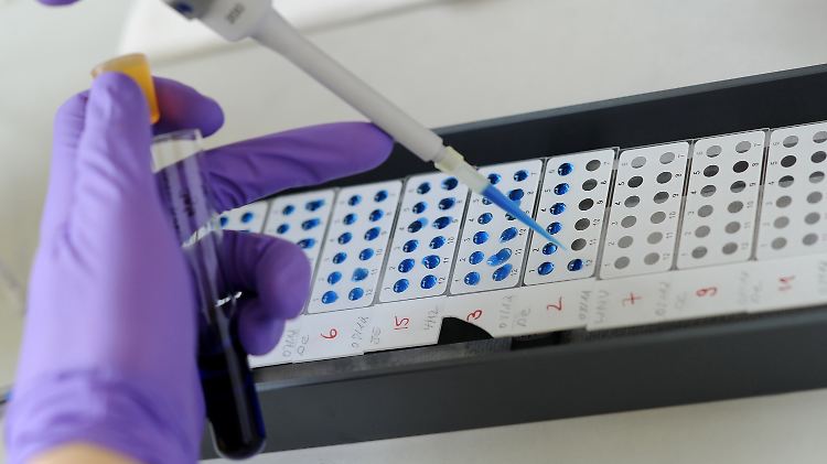 Ein Medizinisch-technischer Assistent (MTA) detektiert in Hamburg im Bernhard-Nocht-Institut für Tropenmedizin (BNI) eine bereits abgeschlossene Antigen-Antikörper-Reaktion