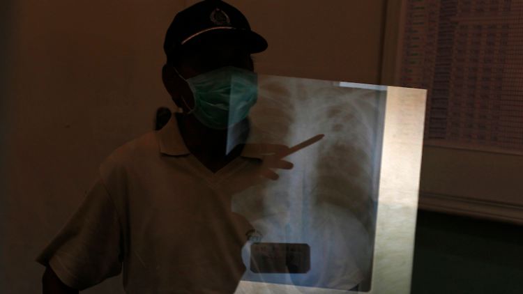 Ein Tuberkulose-Patient in einem Krankenhaus im indonesischen Jakarta.
