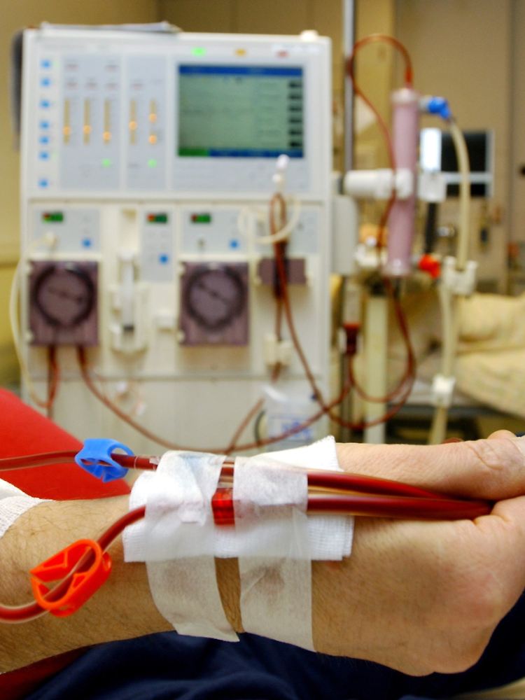 Mit künstlichen Organen und Dialysegeräten können Schwerkranke nur eine bestimmte Zeit überleben.
