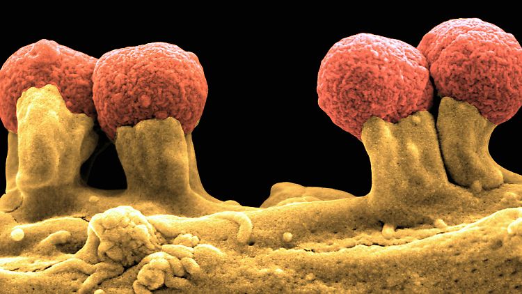 Das krankheitserregende Darmbakterium EPEC (kurz für: Enteropathogene Escherichia coli): Immer mehr Bakterien werden gegen die gängigen Antibiotika resistent.