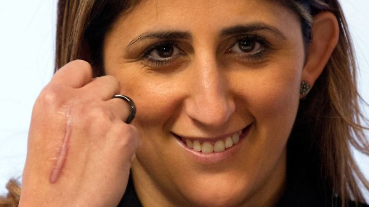 Nicht nur diese Narbe bleibt: Boxerin Rola El-Halabi.