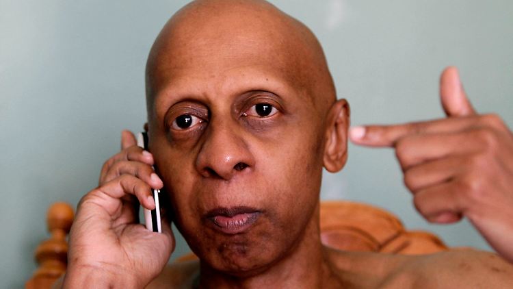Kritik ist noch immer heikel auf Kuba: Guillermo Fariñas bekommt das zu spüren.