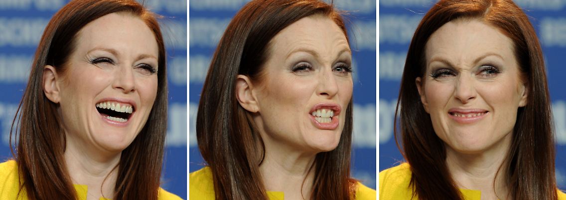 Stimmt, kein Botox.