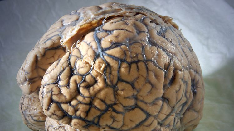 Auch das Geburtsgewicht entscheidet über die Größe des Gehirns.