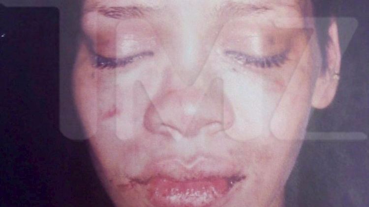 Das Bild der geschlagenen Rihanna ging um die Welt.