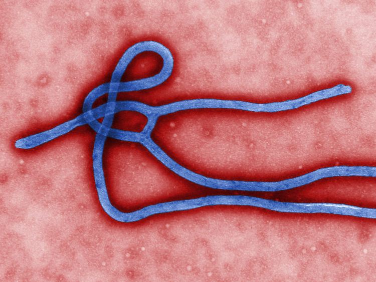 Das Ebola-Virus gehört zu den gefährlichsten Krankheitserregern der Welt.