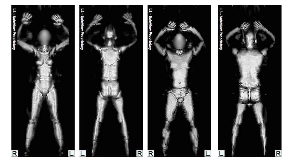 Die Röntgenbilder, die mit Hilfe eines Ganzkörper-Scanners entstanden sind, zeigen weibliche und männliche Personen ohne Kleidung (undatiertes Handout).