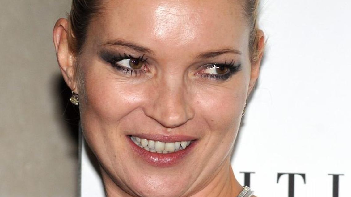 Rauchen macht nicht unbedingt schöner - das gilt auch für Kate Moss ...