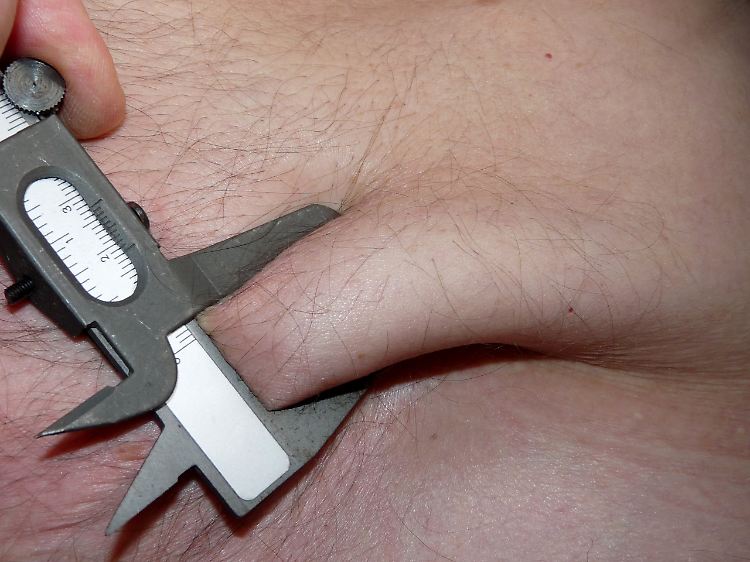 Die Verteilung von Fett über den Körper ist bei Frauen und Männern unterschiedlich.
