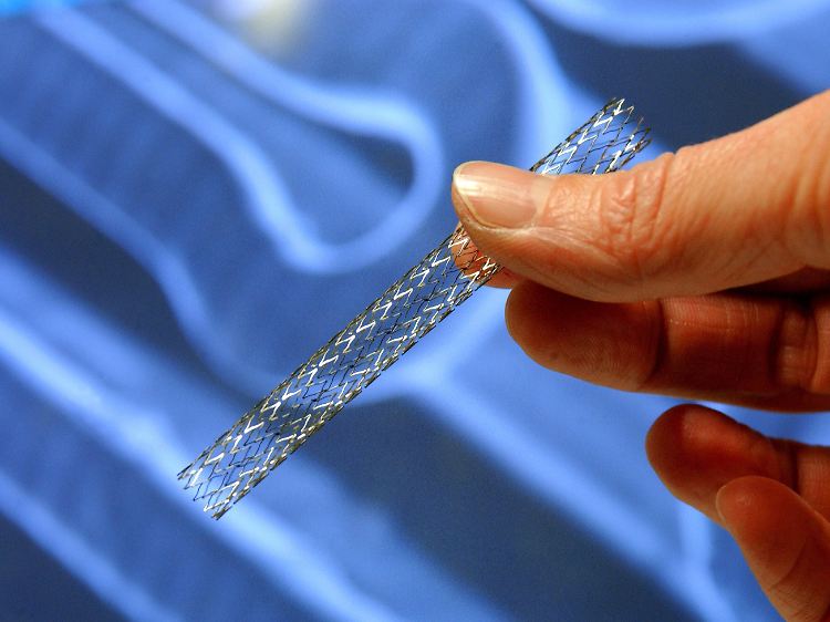 Ein sogenannter Stent. Das winzige Drahtgeflecht wird zum Dehnen von Gefäßverengungen beim Menschen implantiert.