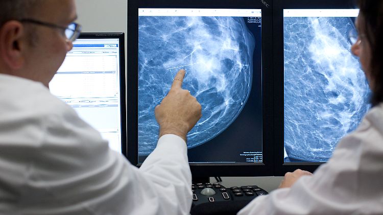 Die Fähigkeit des Körpers zur DNA-Reparatur spielt eine große Rolle, wenn es um das Krebsrisiko geht.