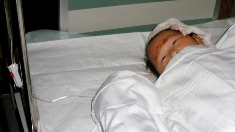 Eines von 29 Kindern, die ein Messerstecher Ende April verletzt hatte.