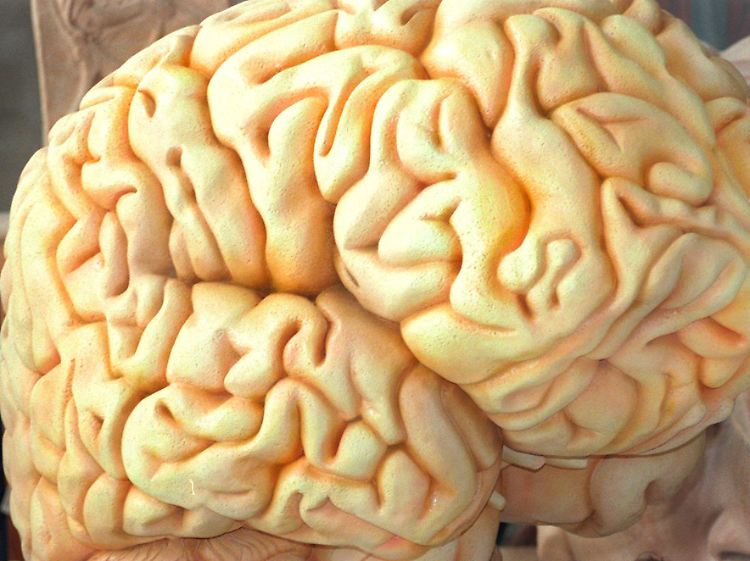 Nach Einnahme der Präparate nimmt das Volumen der grauen Substanz im sogenannten Striatum des Großhirns deutlich ab.