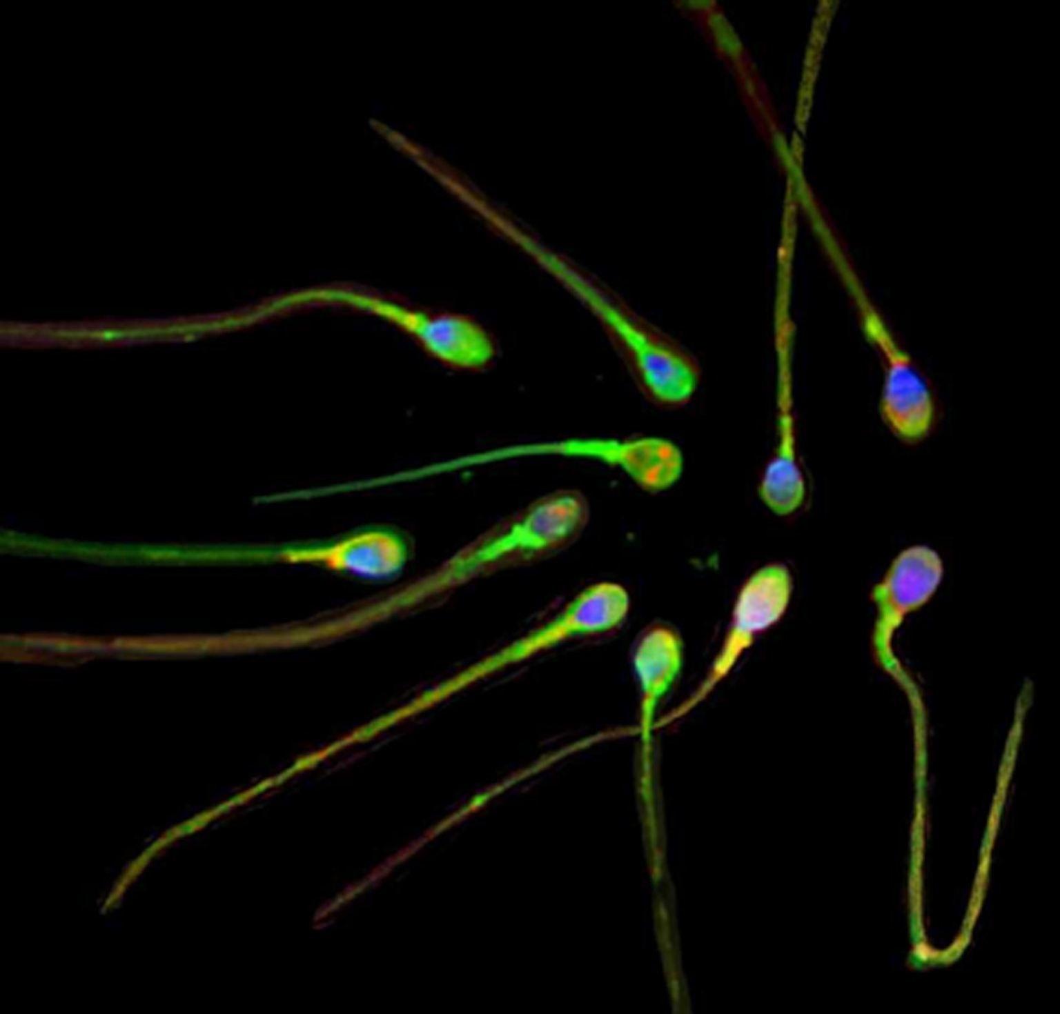 Damit Leben entstehen kann, ...