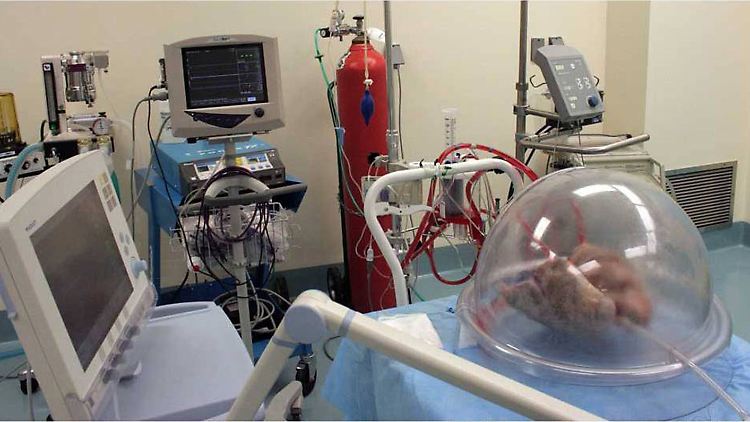 Spenderlungen sind selten. Viele Patienten sterben, bevor sie eine Transplantation bekommen.