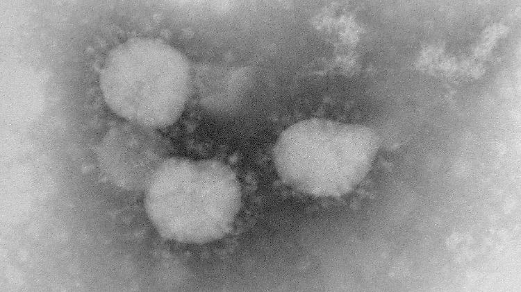 Der neue Coronavirus in mikroskopischer Ansicht, der beim fünften Infizierten entdeckt wurde.