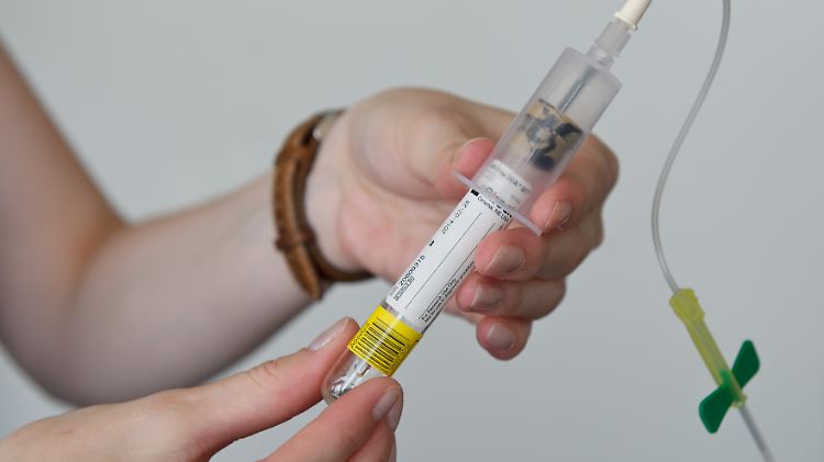 Mit einem einfachen Bluttest kann festgestellt werden, ob das ungeborene Kind Trisomie 21 hat.