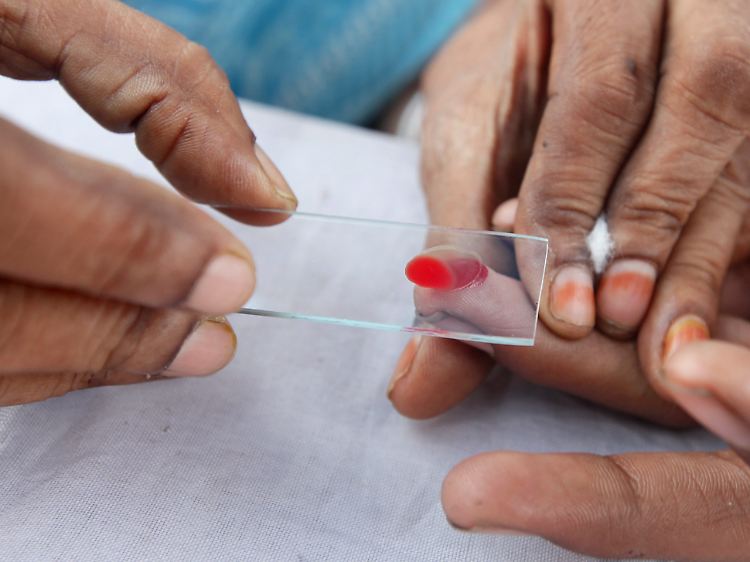 Mit einem Bluttest kann Dengue-Fieber eindeutig diagnostiziert werden.