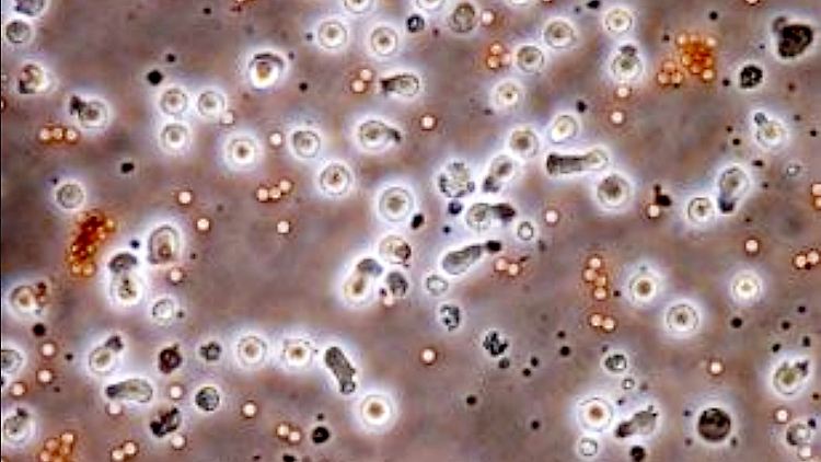 Neuartige weiße Blutkörperchen (T-Lymphozyten), die von japanischen Forschern aus einer Art Stammzellen gewonnen wurden. Diese Zellen, die der Körper auf natürliche Weise nicht selbst herstellen kann, sollen in Zukunft Tumorzellen erkennen und abtöten