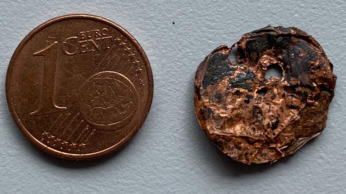 Der Tag: Ärzte finden Ein-Cent-Stück in Lunge eines Mannes - n-tv.de