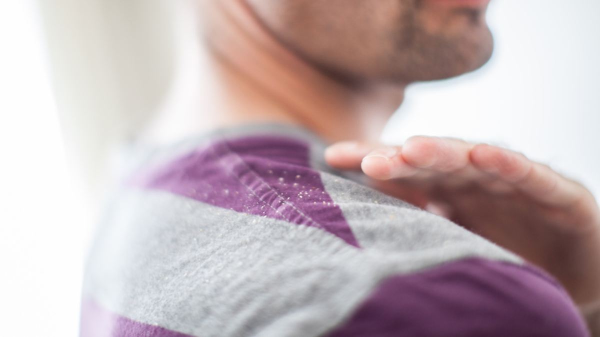 Wie wird man Schuppen wieder los?