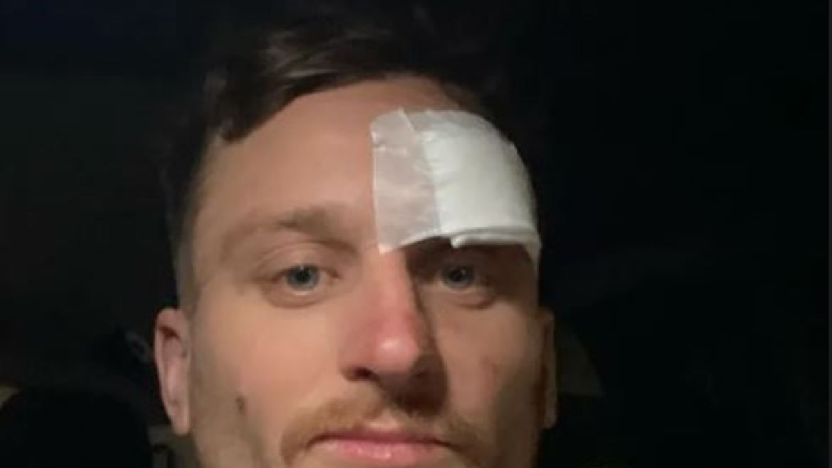 Schlittschuh schneidet Eishockeyprofi Fox die Stirn auf