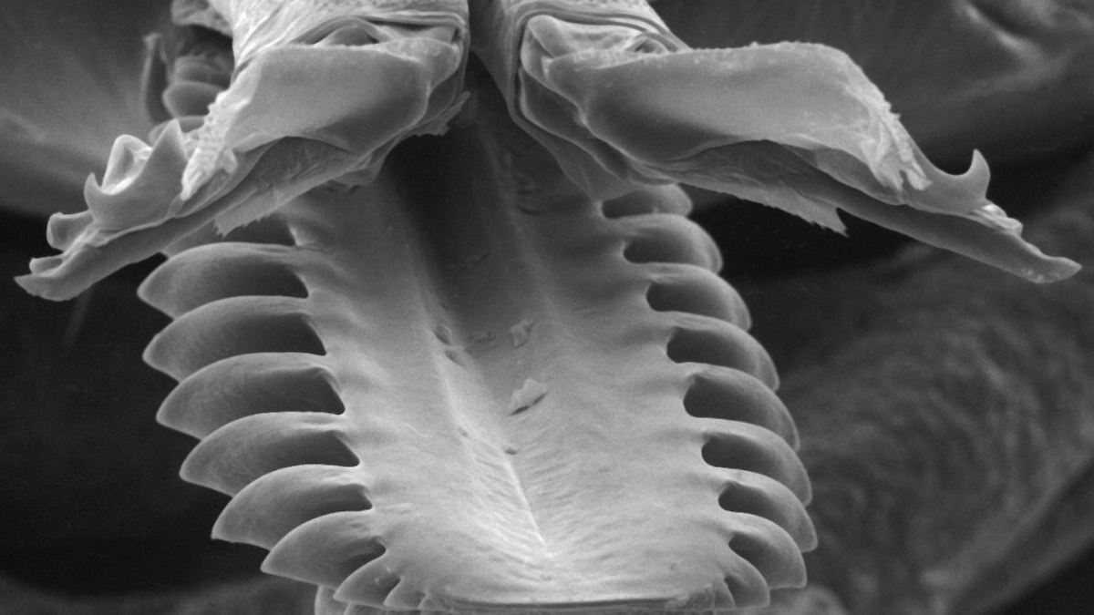 Eine Zeckenart in Deutschland ist besonders gefährlich