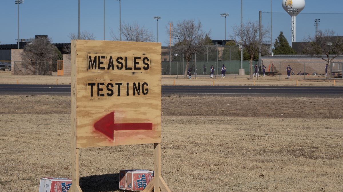 US-Behörde rechnet mit Anstieg von Masernfällen