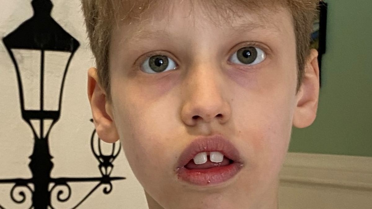 Police search for Bernard: Autistic boy has disappeared again