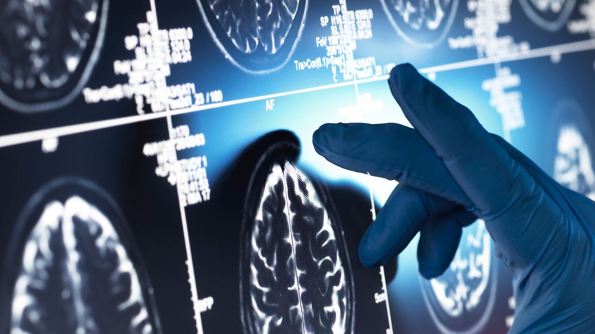 Studie: Politisch extreme Menschen reagieren stärker emotional