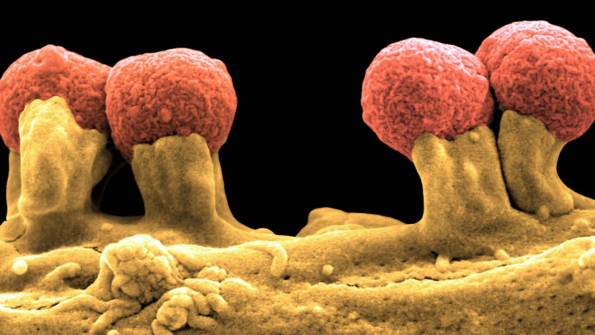 Wie Lange Soll Man Antibiotikum Nehmen
